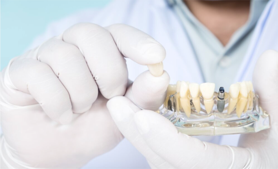 Implantate Gießen- Zahnimplantate vom Spezialisten - Zahnzentrum Dr. Röder und Kollegen