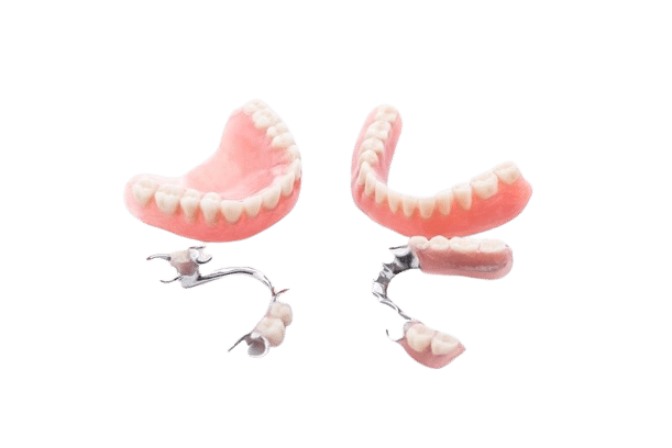 Kombinierter Zahnersatz Giessen - Stegprothesen, Teleskopprothese, Geschiebeprothese