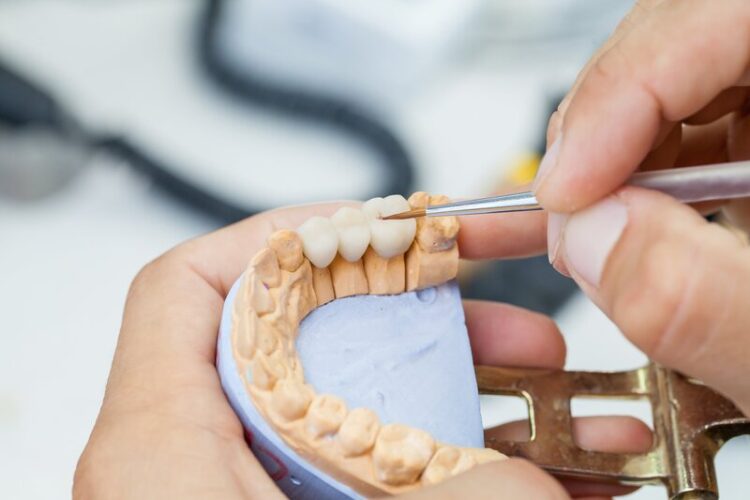 Zahnkronen, Brücken und Inlays aus Keramik in Gießen bei Zahnarzt Dr. Röder und Kollegen
