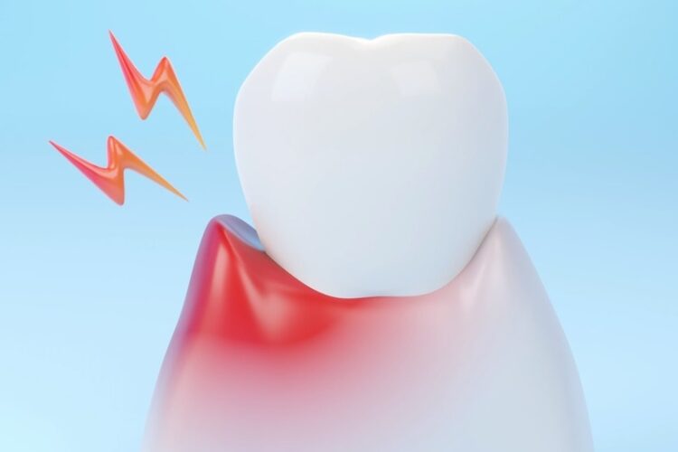 Faktoren, die eine Parodontose begünstigen - Zahnarzt Gießen Dr. Röder und Kollegen
